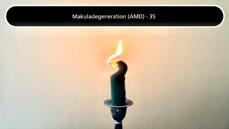 På bilden syns ett ljus som ser krokigt ut. Appen synsimulatorn visar hur olika ögonsjukdomar upplevs